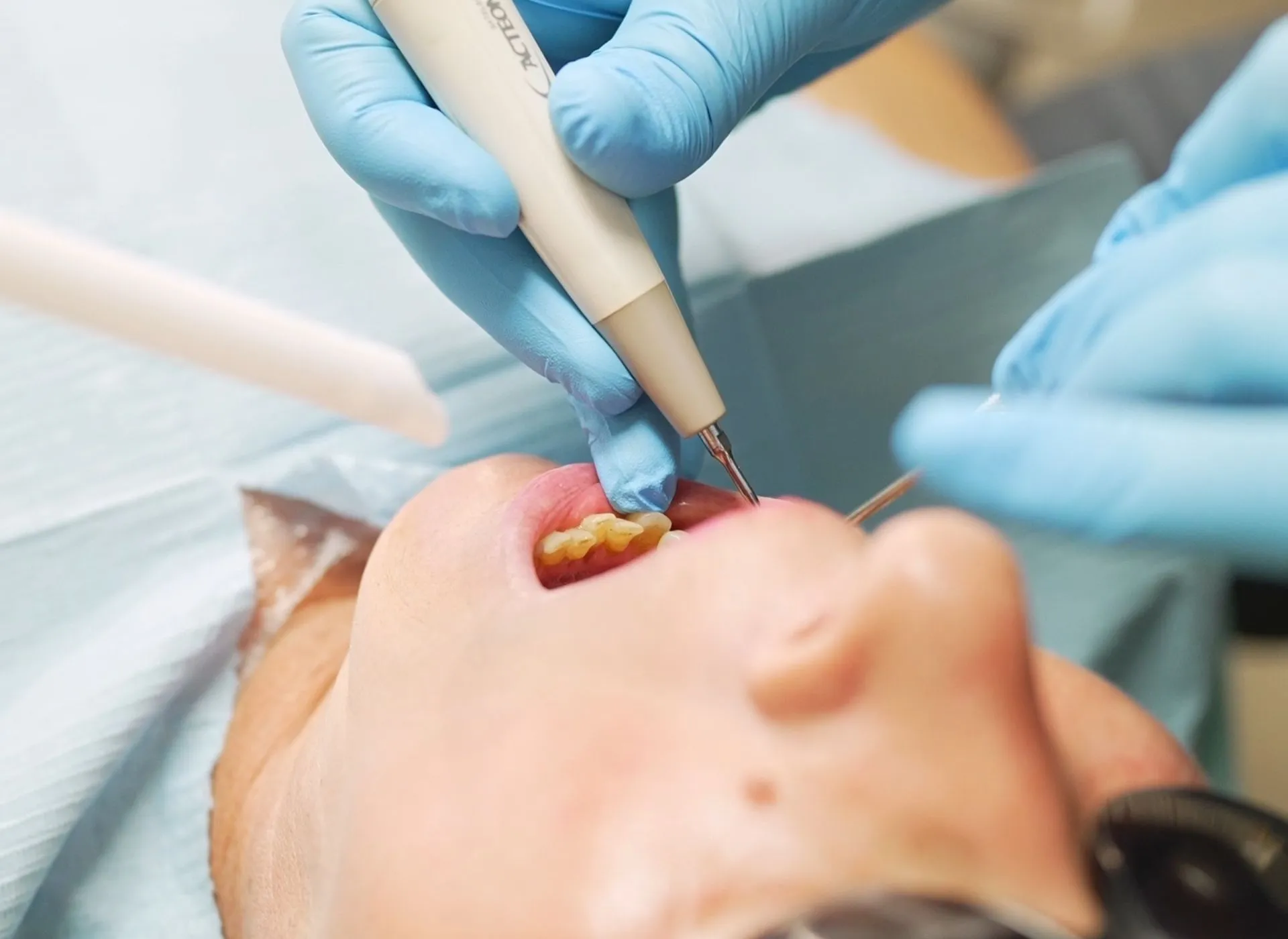 How to Get Rid of Gum Disease