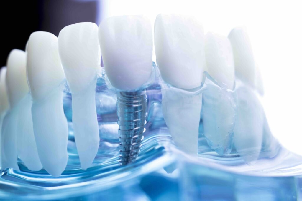 What is modern dental implantology