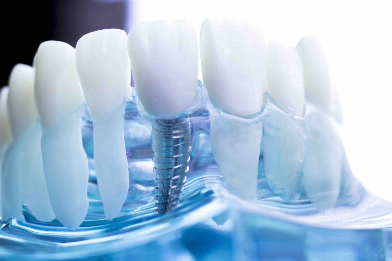 What is modern dental implantology