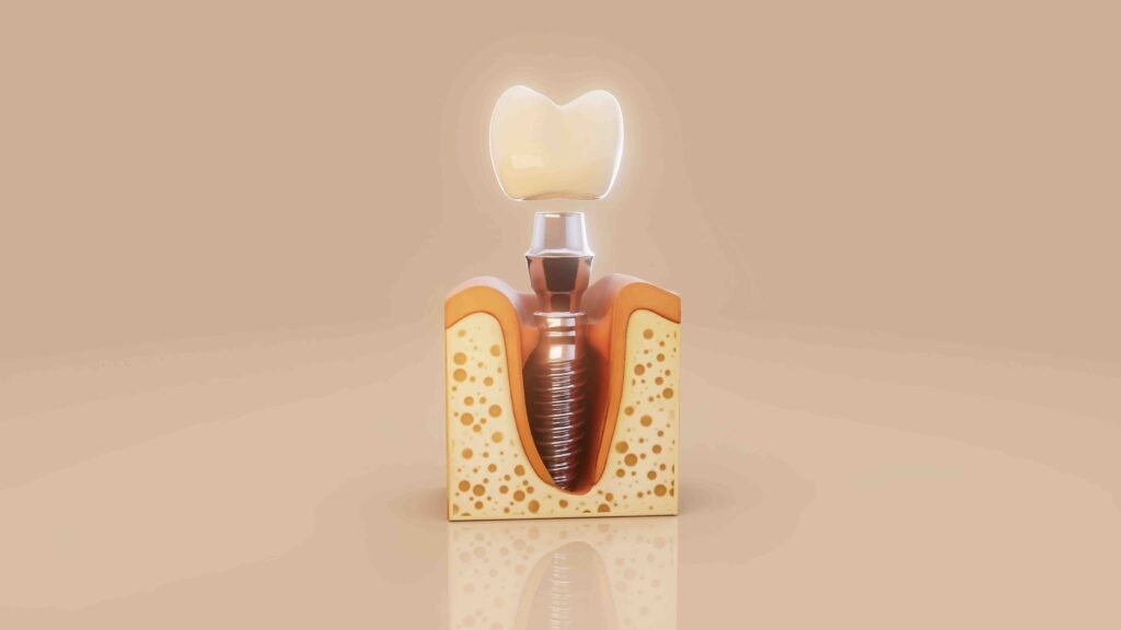 Complete guide to dental implantology