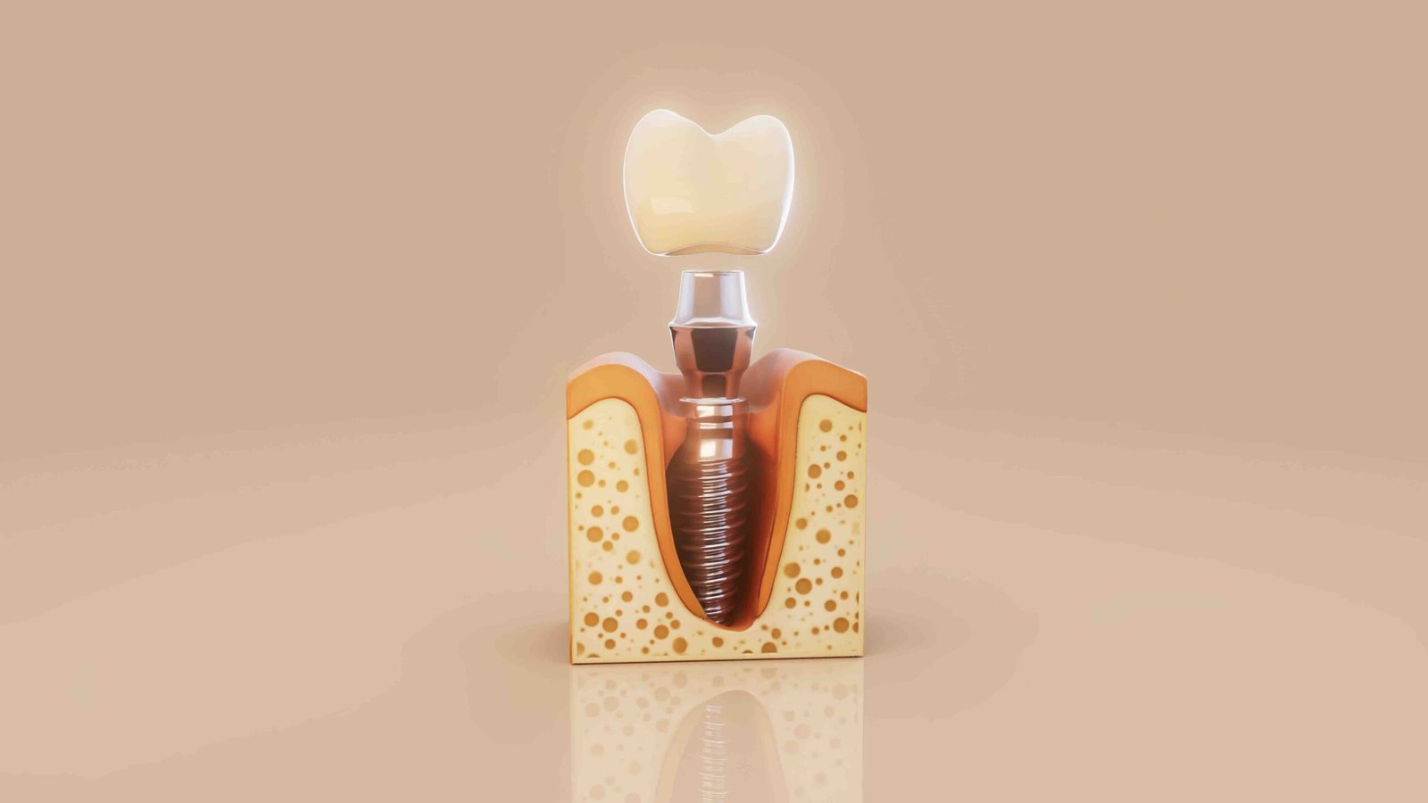 Complete guide to dental implantology